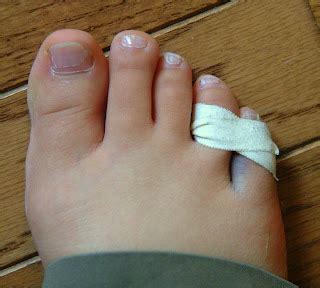 Dr. Jennifer Zienkowski: Radio Personnel, Howard Stern, Fractures his Toe