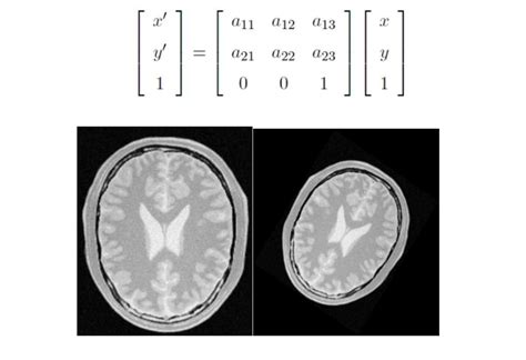 opencv - Calculate the Affine transformation matrix in image Feature based registration - Stack ...