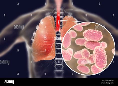 Pertussis Bacteria