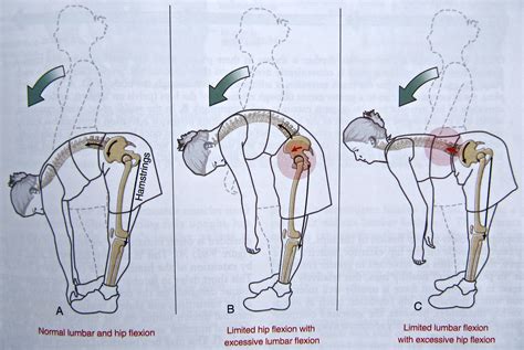 Notes on Anatomy and Physiology: Function of the Thoracolumbar Fascia, Part 1