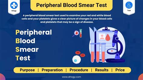 What is a Peripheral Blood Smear normal report?