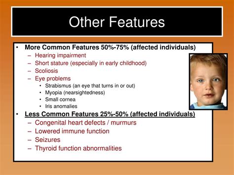 PPT - Smith Magenis Syndrome PowerPoint Presentation, free download - ID:5656784