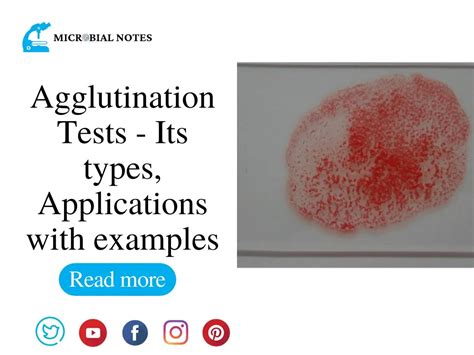 Agglutination Tests - Its types, Applications with examples - Microbial notes