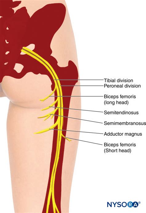 Femoral And Sciatic Nerve