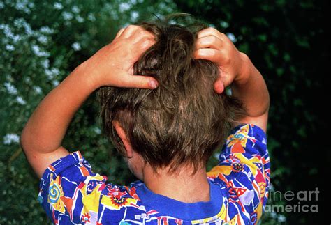 Head Lice: 3-year-old Boy Scratches His Head Photograph by Mark Clarke ...