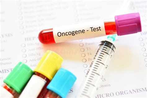 Blood Sample for Oncogene Test Stock Image - Image of laboratory, liver ...