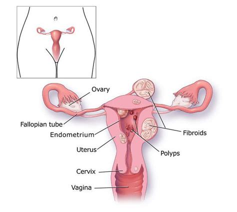 Complications of menorrhagia - MEDizzy