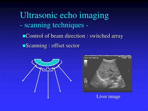 PPT - Foundations of Medical Ultrasonic Imaging PowerPoint Presentation ...