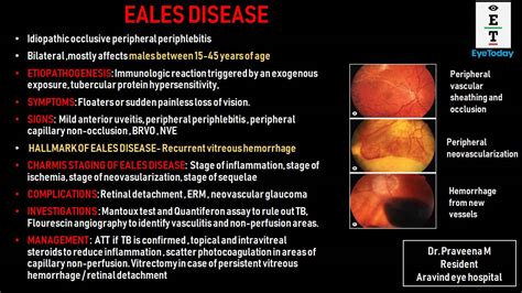 Eales Disease - EyeToday