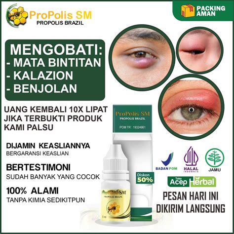 Jual Obat Mata Bengkak Obat Mata Bintitan Obat Mata Kalazion Obat Mata ...