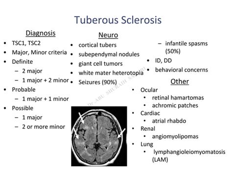 Neurocutaneous disorders