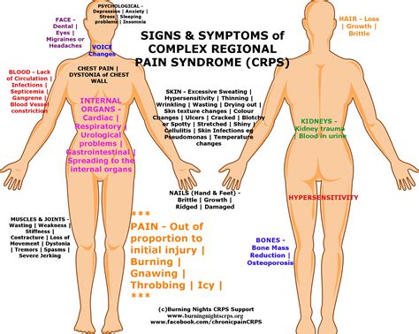 What is complex regional pain syndrome (CRPS)?