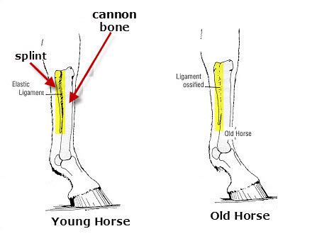 What Is A Popped Splint?