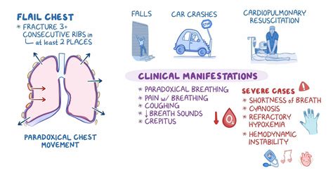 Video: Flail chest: Nursing