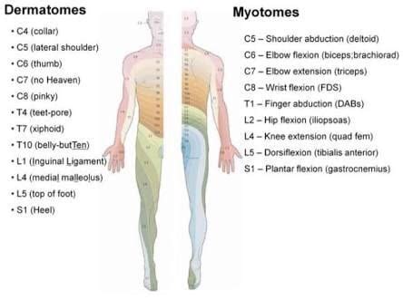 l5 dermatome and myotome - Google Search | 健