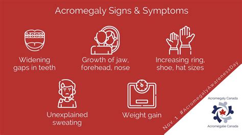 Acromegaly symptoms : r/acromegaly