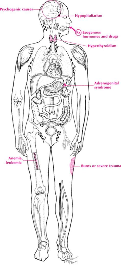 Hypomenorrhea and Amenorrhea - Differential Diagnosis in Primary Care ...