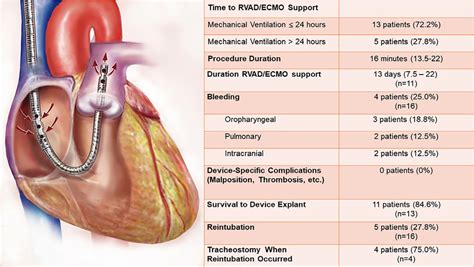 -RVAD/ECMO specific outcomes. The TandemLife Protek Duo is a ...