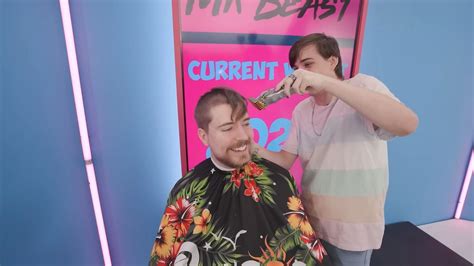 Is MrBeast going Bald?