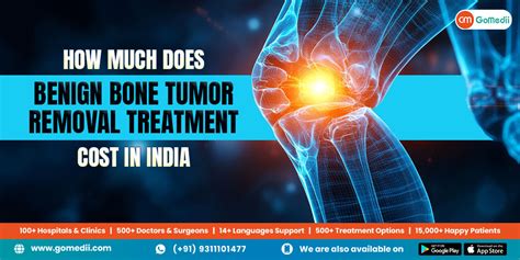 How Much Does Benign Bone Tumor Removal Treatment cost In India