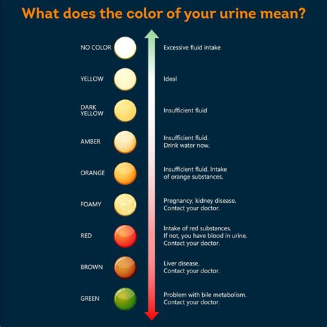 What Causes Dark Urine? - Pristyn Care