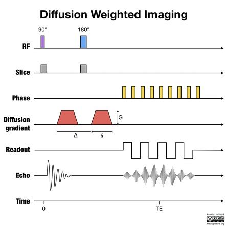 Diffusion-weighted imaging | Radiology Reference Article | Radiopaedia.org