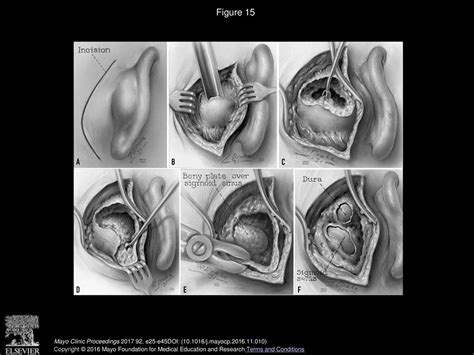 The History of Otorhinolaryngology at Mayo Clinic - ppt download