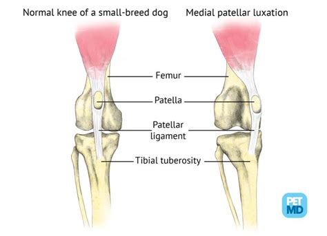 Patellar Luxation in Dogs Medical Diagram | PetMD