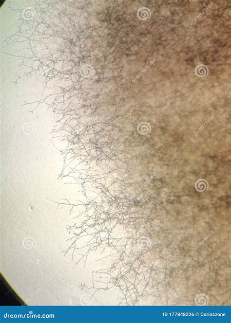 Dermatphyte Fungus Under the Microscope Stock Photo - Image of view ...