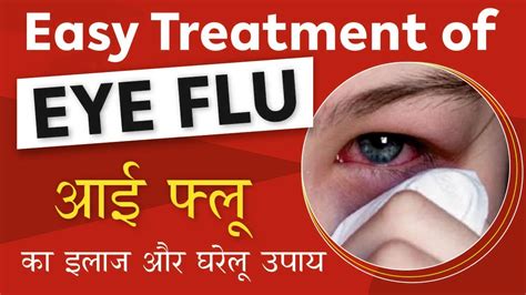 Eye Flu Prevention Tips: बारिश से बढ़ रही आंखों की ये बीमारी, जानें क्या है लक्षण - U9M