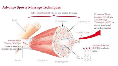 What Causes Delayed Onset Muscle Soreness (DOMS)?