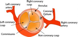 Aortic valve anatomy - Critical Care Sonography