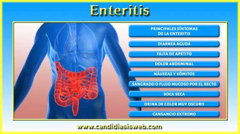 inflamacion del intestino grueso sintomas – porque se inflaman los ...