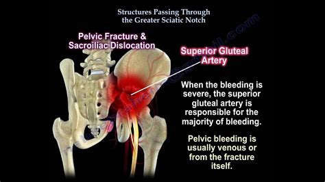 Greater And Lesser Sciatic Notch Of Hip Bone / Lumbosacral plexus ...