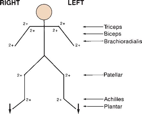 A Tendon Reflex Will Cause Which of the Following Responses