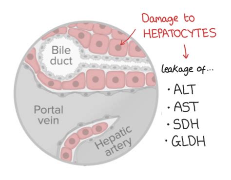 Laboratory Diagnosis of Liver Disease Flashcards | Quizlet