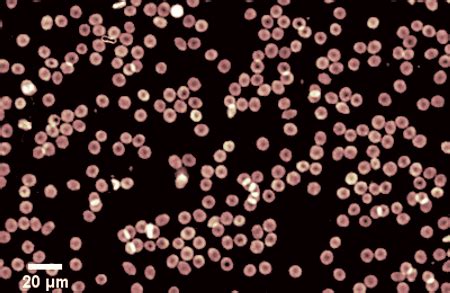 Red Blood Cell RBC - LyncéeTec