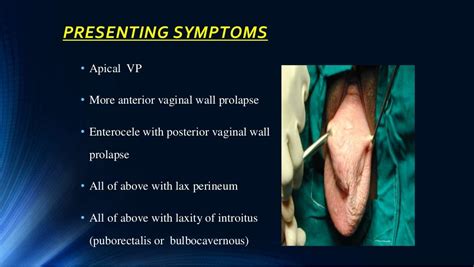 Vault prolapse, Pelvic organ Prolapse, Supports Of Uterus