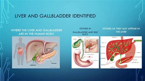 Liver and Gallbladder Function and Stones Surgery and Flushes | Gallbladder, Liver, Surgery