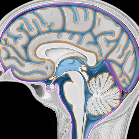 Cranial leptomeninges , graphic display [1 of 8]