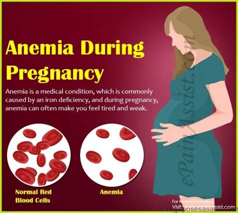 What Does It Mean If Your Hemoglobin Is Low In Pregnancy - Peter Brown ...