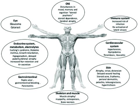 Glucocorticoid side effects ordered by the affected organs. | Download Scientific Diagram