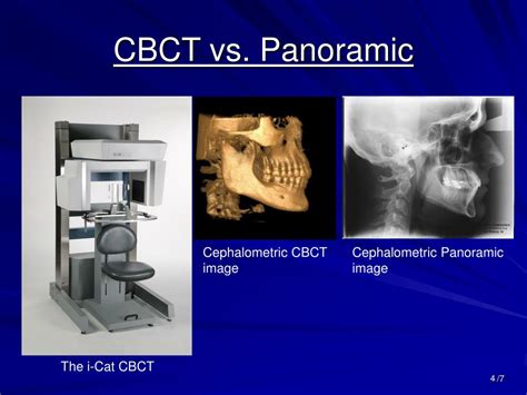 PPT - Dental Cone Beam CT PowerPoint Presentation, free download - ID ...