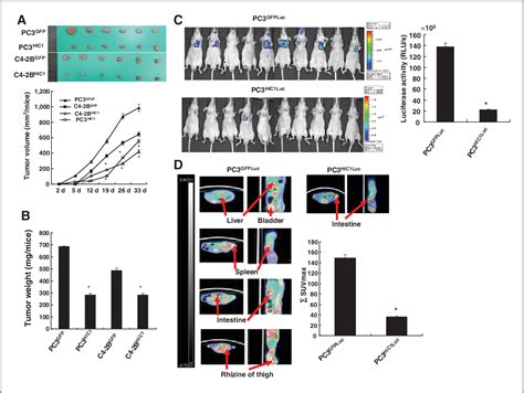 Figure 3 from HIC1 Modulates Prostate Cancer Progression by Epigenetic Modification | Semantic ...