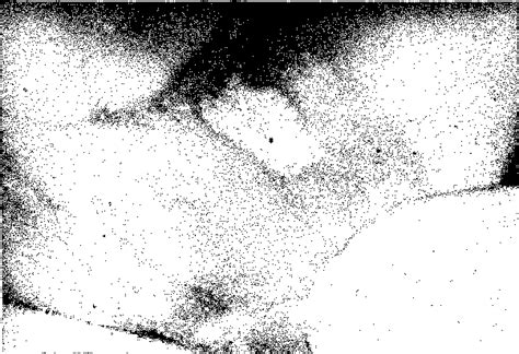 Figure 1 from Recurrent aphthous stomatitis. | Semantic Scholar