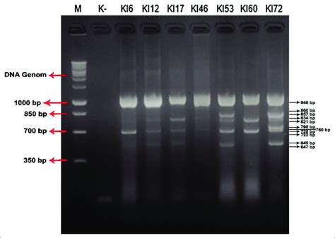 Gel electrophoresis of the polymerize chain reaction (PCR) products... | Download Scientific Diagram