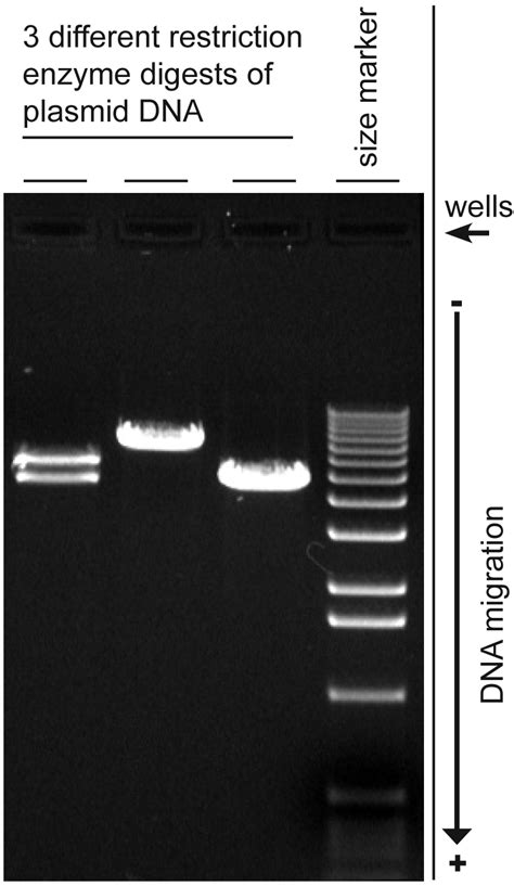 Agarose gel electrophoresis - Wikipedia