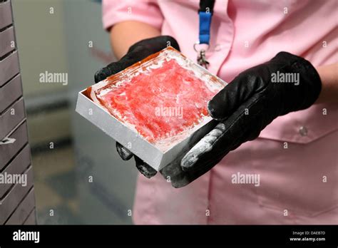 Cord blood stem cells hi-res stock photography and images - Alamy