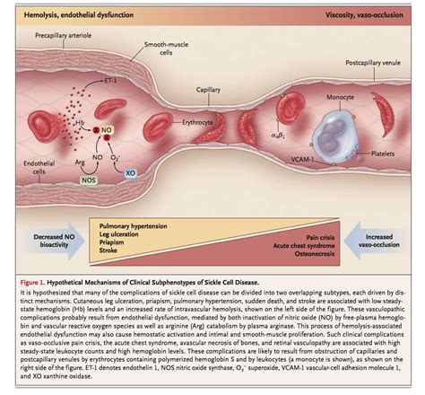 Hemolytic Anemia - IM Reference