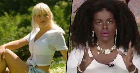 Model Who Took Melanin Injections Says She Hasn't Experienced Racism